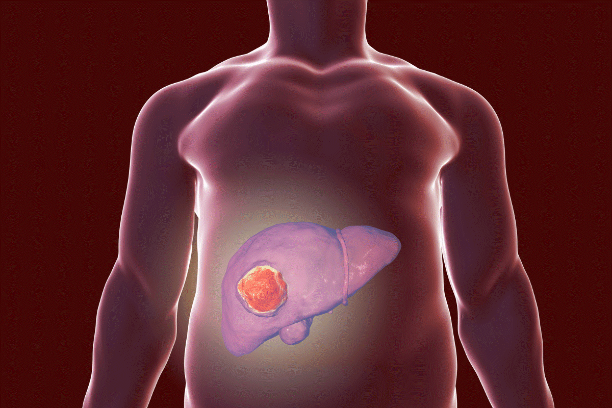 liver disorders ayurvedic treatment dubai
